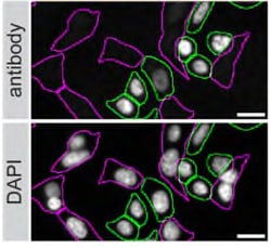 Invitrogen ARID1A Recombinant Rabbit Monoclonal Antibody (JJ09-01) 100 &mu;L | Buy Online | Invitrogen&trade; | Fisher Scientific