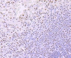 Invitrogen ARID1A Recombinant Rabbit Monoclonal Antibody (JJ09-01) 100 &mu;L | Buy Online | Invitrogen&trade; | Fisher Scientific