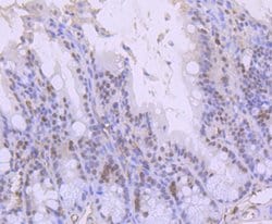 Invitrogen ARID1A Recombinant Rabbit Monoclonal Antibody (JJ09-01) 100 &mu;L | Buy Online | Invitrogen&trade; | Fisher Scientific