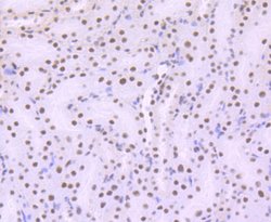 Invitrogen ARID1A Recombinant Rabbit Monoclonal Antibody (JJ09-01) 100 &mu;L | Buy Online | Invitrogen&trade; | Fisher Scientific