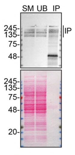 Invitrogen ARID1A Recombinant Rabbit Monoclonal Antibody (JJ09-01) 100 &mu;L | Buy Online | Invitrogen&trade; | Fisher Scientific