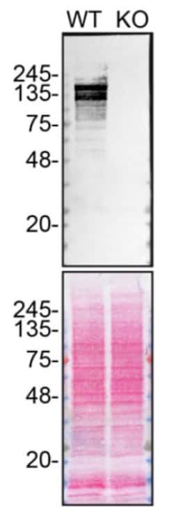Invitrogen ARID1A Recombinant Rabbit Monoclonal Antibody (JJ09-01) 100 &mu;L | Buy Online | Invitrogen&trade; | Fisher Scientific
