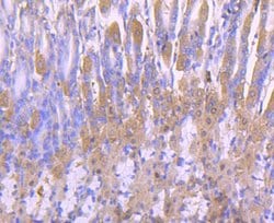 Invitrogen PRDX2 Recombinant Rabbit Monoclonal Antibody (JJ090-3) 100 &mu;L;