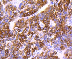 Invitrogen COX4 Recombinant Rabbit Monoclonal Antibody (JJ09-05) 100 &mu;L;