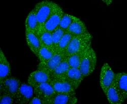 Invitrogen HDAC6 Recombinant Rabbit Monoclonal Antibody (JJ09-09) 100 &mu;L;