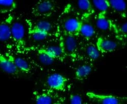 Invitrogen HDAC6 Recombinant Rabbit Monoclonal Antibody (JJ09-09) 100 &mu;L;