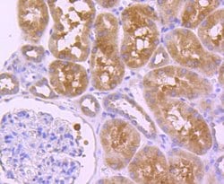 Invitrogen HDAC6 Recombinant Rabbit Monoclonal Antibody (JJ09-09) 100 &mu;L;