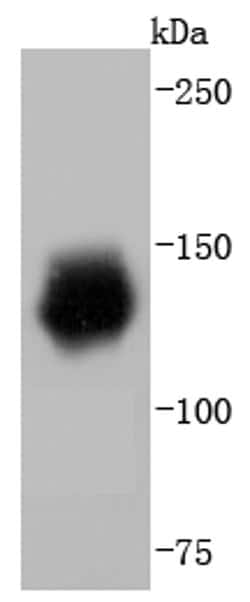 Invitrogen HDAC6 Recombinant Rabbit Monoclonal Antibody (JJ09-09) 100 &mu;L;