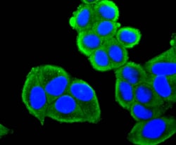 Invitrogen FOXO4 Recombinant Rabbit Monoclonal Antibody (JJ09-11) 100 &mu;L;