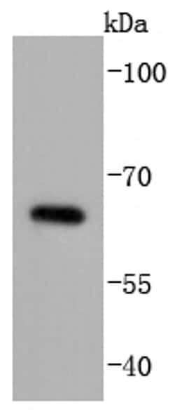 Invitrogen Cdc25B Recombinant Rabbit Monoclonal Antibody (JJ091-2) 100