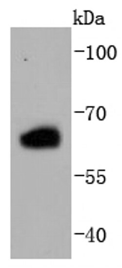 Invitrogen Estrogen Receptor beta Recombinant Rabbit Monoclonal Antibody