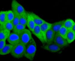 Invitrogen HSP27 Recombinant Rabbit Monoclonal Antibody (JJ09-13) 100 &mu;L;
