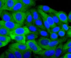 Invitrogen HSP27 Recombinant Rabbit Monoclonal Antibody (JJ09-13) 100 &mu;L;