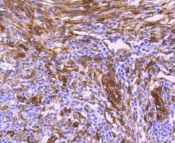 Invitrogen HSP27 Recombinant Rabbit Monoclonal Antibody (JJ09-13) 100 &mu;L;