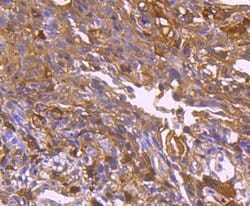 Invitrogen HSP27 Recombinant Rabbit Monoclonal Antibody (JJ09-13) 100 &mu;L;