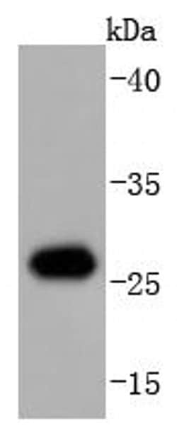Invitrogen HSP27 Recombinant Rabbit Monoclonal Antibody (JJ09-13) 100 &mu;L;