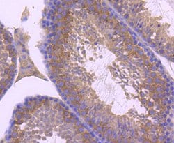 Invitrogen ZNRF2 Recombinant Rabbit Monoclonal Antibody (JJ0924) 100 &mu;L;