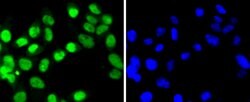 Invitrogen SUMO4 Recombinant Rabbit Monoclonal Antibody (JJ085-01) 100