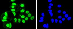 Invitrogen SUMO4 Recombinant Rabbit Monoclonal Antibody (JJ085-01) 100
