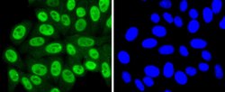 Invitrogen SUMO4 Recombinant Rabbit Monoclonal Antibody (JJ085-01) 100