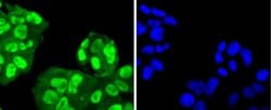 Invitrogen SUMO4 Recombinant Rabbit Monoclonal Antibody (JJ085-01) 100