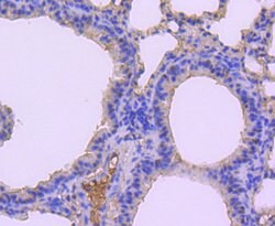 Invitrogen MKP-1 Recombinant Rabbit Monoclonal Antibody (JJ0930) 100 &mu;L | Buy Online | Invitrogen&trade; | Fisher Scientific