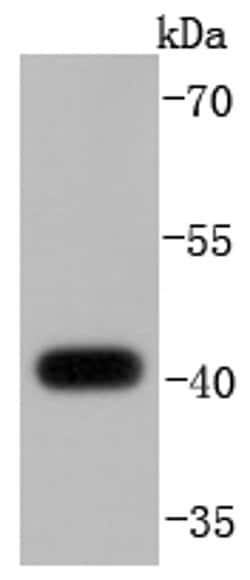 Invitrogen MKP-1 Recombinant Rabbit Monoclonal Antibody (JJ0930) 100 &mu;L | Buy Online | Invitrogen&trade; | Fisher Scientific