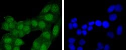 Invitrogen 4EBP1 Recombinant Rabbit Monoclonal Antibody (JJ09-25) 100 &mu;L;