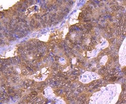 Invitrogen 4EBP1 Recombinant Rabbit Monoclonal Antibody (JJ09-25) 100 &mu;L;