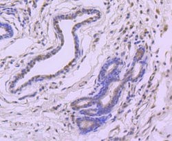 Invitrogen 4EBP1 Recombinant Rabbit Monoclonal Antibody (JJ09-25) 100 &mu;L;