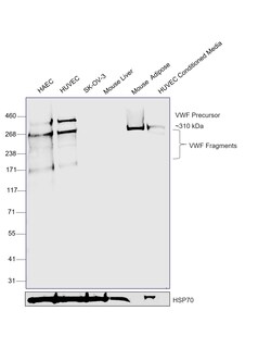 Invitrogen VWF Recombinant Rabbit Monoclonal Antibody (JJ09-34) 100 &mu;L;