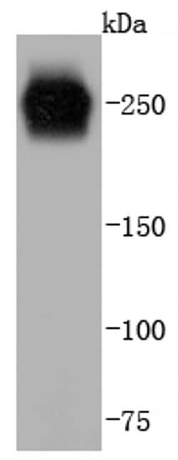 Invitrogen VWF Recombinant Rabbit Monoclonal Antibody (JJ09-34) 100 &mu;L;
