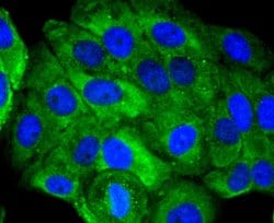 Invitrogen&trade;&nbsp;UBD Recombinant Rabbit Monoclonal Antibody (JJ084-09)