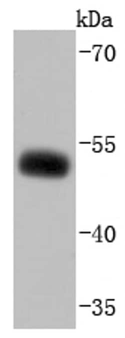 Invitrogen EBP50 Recombinant Rabbit Monoclonal Antibody (JJ0946) 100 &mu;L;