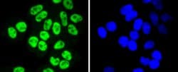 Invitrogen SP1 Recombinant Rabbit Monoclonal Antibody (JF0950) 100 &mu;L;