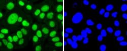 Invitrogen SP1 Recombinant Rabbit Monoclonal Antibody (JF0950) 100 &mu;L;