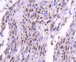 Invitrogen SP1 Recombinant Rabbit Monoclonal Antibody (JF0950) 100 &mu;L;
