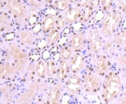 Invitrogen SP1 Recombinant Rabbit Monoclonal Antibody (JF0950) 100 &mu;L;