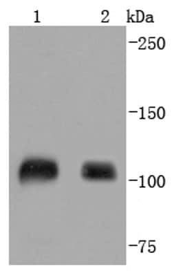 Invitrogen SP1 Recombinant Rabbit Monoclonal Antibody (JF0950) 100 &mu;L;