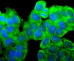 Invitrogen RPSA Recombinant Rabbit Monoclonal Antibody (JF0955) 100 &mu;L;