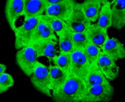 Invitrogen RPSA Recombinant Rabbit Monoclonal Antibody (JF0955) 100 &mu;L;