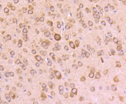 Invitrogen RPSA Recombinant Rabbit Monoclonal Antibody (JF0955) 100 &mu;L;