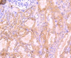 Invitrogen RPSA Recombinant Rabbit Monoclonal Antibody (JF0955) 100 &mu;L;