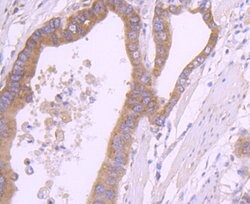 Invitrogen RPSA Recombinant Rabbit Monoclonal Antibody (JF0955) 100 &mu;L;