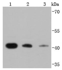 Invitrogen RPSA Recombinant Rabbit Monoclonal Antibody (JF0955) 100 &mu;L;