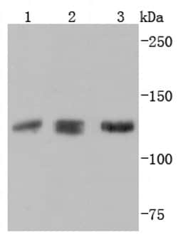 Invitrogen Abl2 Recombinant Rabbit Monoclonal Antibody (JF0951) 100 &mu;L;