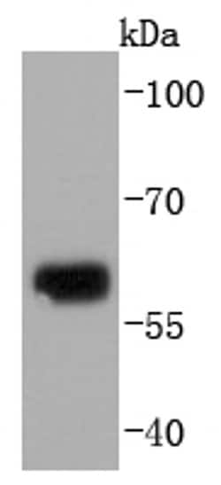 Invitrogen Collagen X Recombinant Rabbit Monoclonal Antibody (JF0961) 100 &mu;L | Buy Online | Invitrogen&trade; | Fisher Scientific