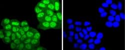 Invitrogen Phospho-PKC alpha (Thr638) Recombinant Rabbit Monoclonal Antibody