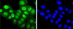 Invitrogen Phospho-PKC alpha (Thr638) Recombinant Rabbit Monoclonal Antibody