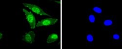 Invitrogen Phospho-PKC alpha (Thr638) Recombinant Rabbit Monoclonal Antibody
